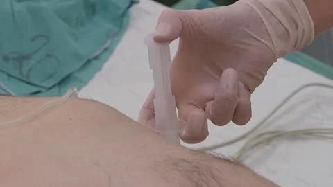 General anesthesia. Stock Footage 111244446