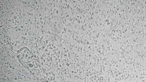 Genetic sample. Reproductive function of man. Slow motion filming of the Stock Footage 258641299