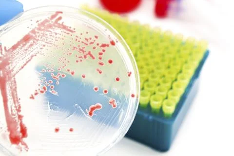 Genetically modified microorganisms on agar plate in laboratory Stock Photos