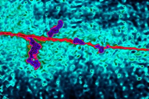  Genetics, dna Digital light microscope. Strand of RNA on DNA fragment. Co... Stock Photos