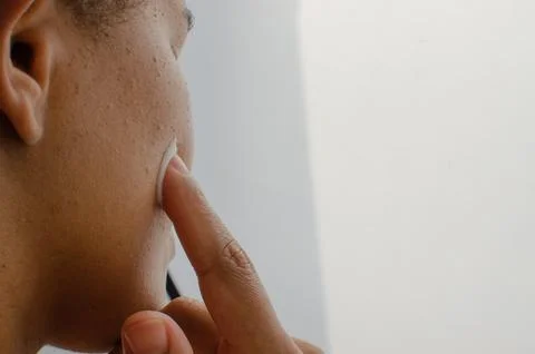 Gentle hands gently applying face cream, moisturizing the skin with care an.. 库存照片