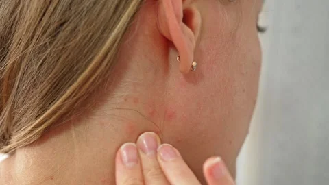 Gentle Touch on a Woman's Delicate Neck Area Stock Footage 337869739