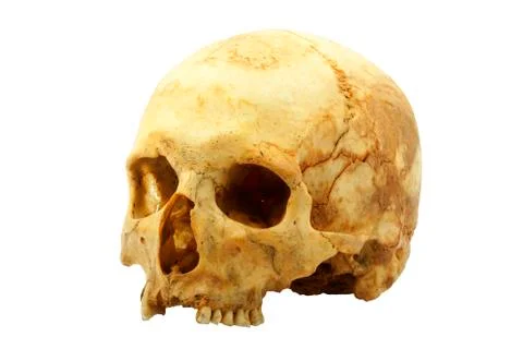 Genuine human skull isolated on white, lipids makes skull yellow Stock Photos
