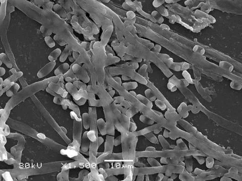 Genuine scanning electron microscope images of fungi mycelium and spores Stock Photos