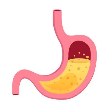 Gerd stomach icon in flat style. Reflux vector illustration on isolated bac.. Stock Illustration