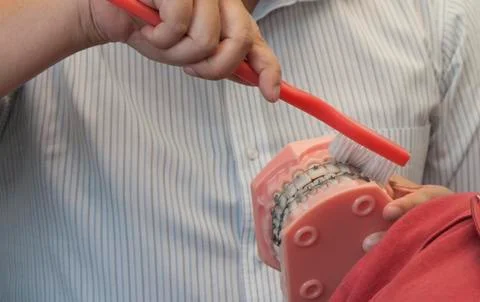 Getting braces on your teeth Stock Photos