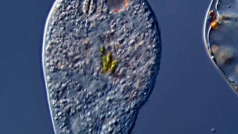 Giant ciliophora under microscope view 库存影片 310316360