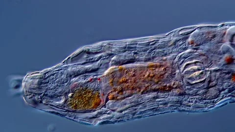Giant rotifer under microscope view 400x magnification 库存影片 310313368