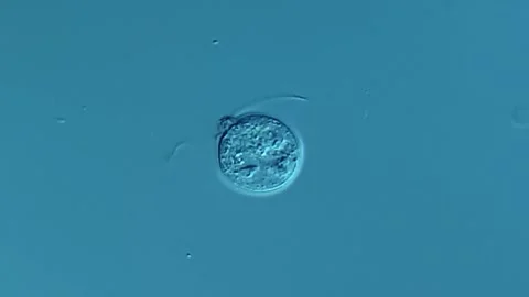 Giardia  parasite under DIC microscope view Vídeos de archivo 306581607