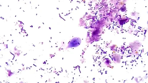 Giardia under microscope, Canine Stool smear 库存影片 306578699