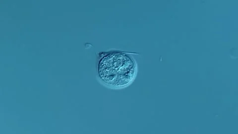 Giardia under microscope, feces sample Vidéo 306581475