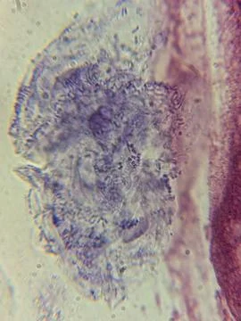 Giemsa-Stained Squamous Epithelial Cells with Nucleus and Adherent Bacteria.. 스톡 사진