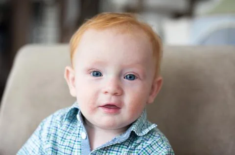 Ginger boy with allergies Stock Photos