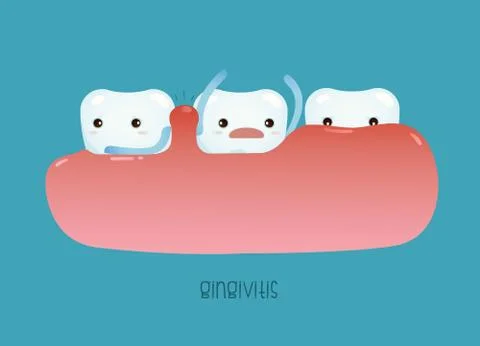 Gingivitis of dental vector Stock Illustration