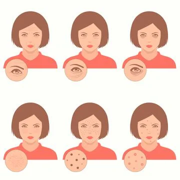 Girl with acne problems Stock Illustration