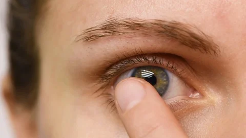 A girl cannot remove a contact lens for vision. Vidéo 101239313