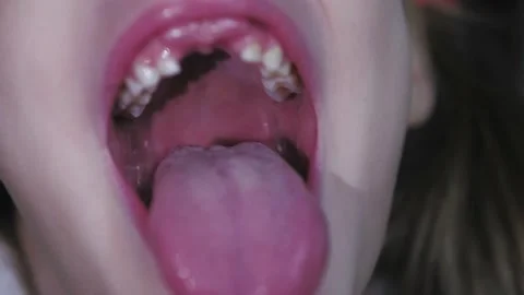 Giantess Uvula