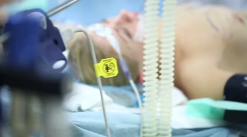 The girl on the operating table Видео 61114096