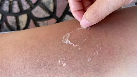 Girl is peeling her dead skin off from her leg Stock Footage 136446853