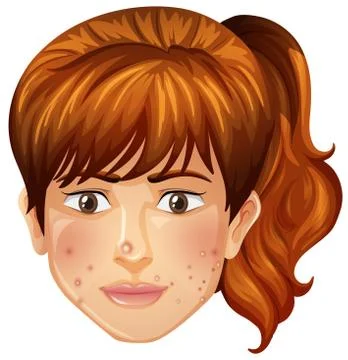 A Girl with Pimples Problem Stock Illustration