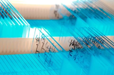 Glass microscope slide Foto stock