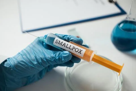 Glass slide with blood sample for monkeypox virus test. Test tube, flask wit Stock Photos