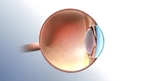 Glaucoma eye disease 3D illustration medical イラスト素材