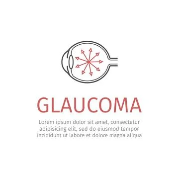 Glaucoma. Human eye. Vector illustration. Stock Illustration