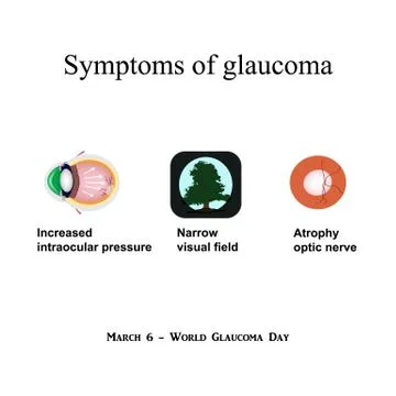 Glaucoma. Symptoms of glaucoma. Atrophy of the optic nerve. Field of view at Stock Illustration