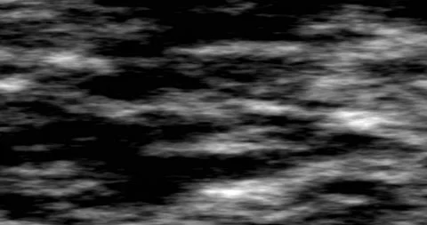 Glitch Animation spline-sh Stock Footage 179530975