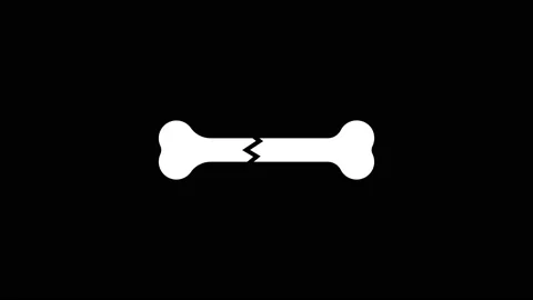 Glitch broken bone icon on black background. Stock Footage 170322495
