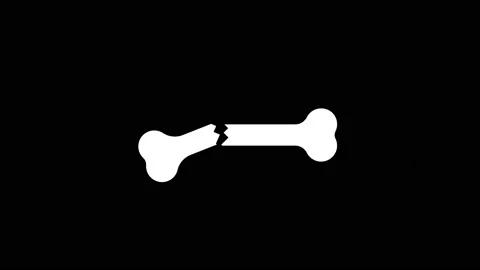 Glitch broken bone icon on black background. Stock Footage 170322514