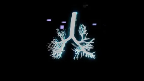 Glitch effect. Human lung scanner screen. Stock Footage 304030661
