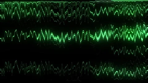 Glitch green background. Abstract screen with noise effect. Stock Footage 318588571