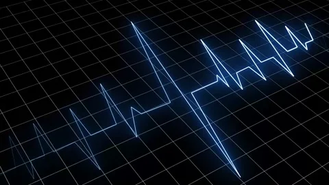 Glitched and distorted blue heartbeat line on a grid Stock Footage 317128407