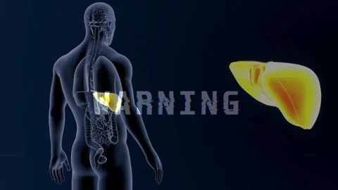 Glitching Warning Text Between Human Anatomy and Enlarged Liver Stock Footage 336900581