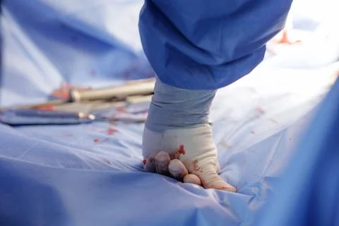 Gloved hand controlling bleeding on sterile drape in operating theatre Stock Photos