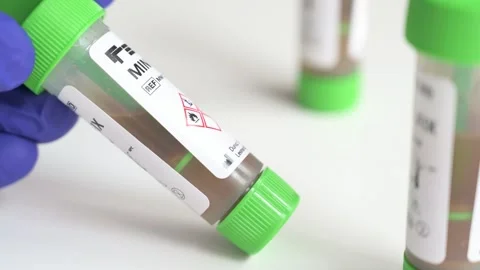 Gloved hand holding a stool test tube for lab analysis Stock Footage 336733526