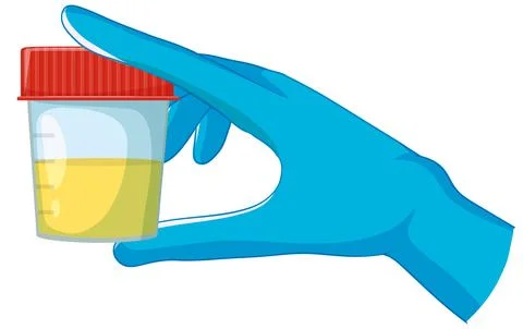 Gloved Hand Holding Urine Sample Container Stock Illustration