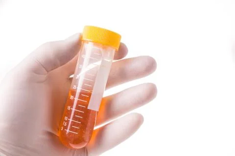 Gloved hand keeps the filled sample tube Stock Photos