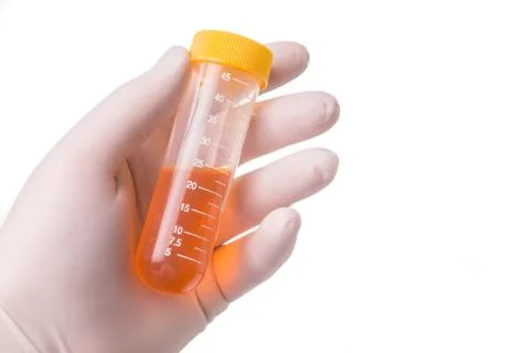 Gloved hand keeps the filled sample tube Stock Photos