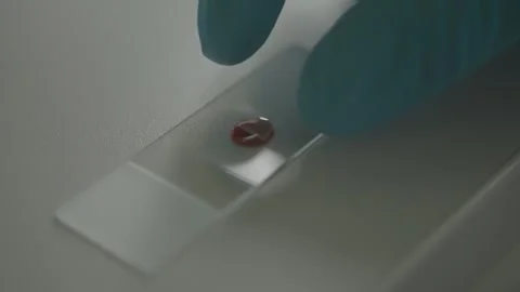Gloved hand placing blood sample on a slide for microscopic examination Stock Footage 280751645