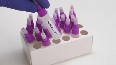Gloved Hand Selects Hantavirus Sample from Rack of Purple-Capped Vials Stock Footage 334602641