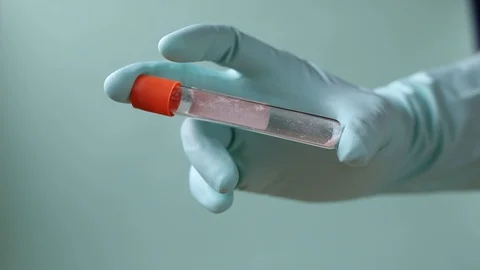 Gloved hands with a blood test Stock Footage