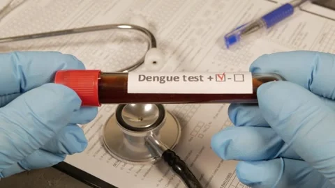 Gloved hands holding a test tube with blood sample positive for dengue Stock Footage 310963553
