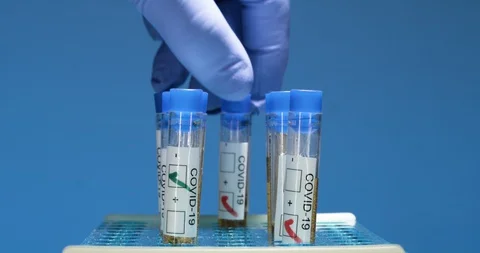 Gloved hands picking up a vial for COVID-19 research healthcare Stock Footage 127677236