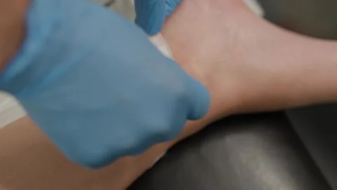 Gloved Hands Pressing Cotton Pad on Patient Ankle After Vein Procedure Stock Footage 342286374