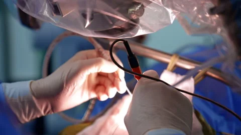 Gloved hands of the surgeon using modern electric equipment. Neurosurgery Stock Footage 331081626