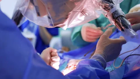 Gloved hands of the unrecognized surgeon performing operation Stock Footage 310630085