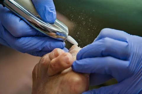 Gloved hands use an instrument to file the nails on a foot. Stock Photos